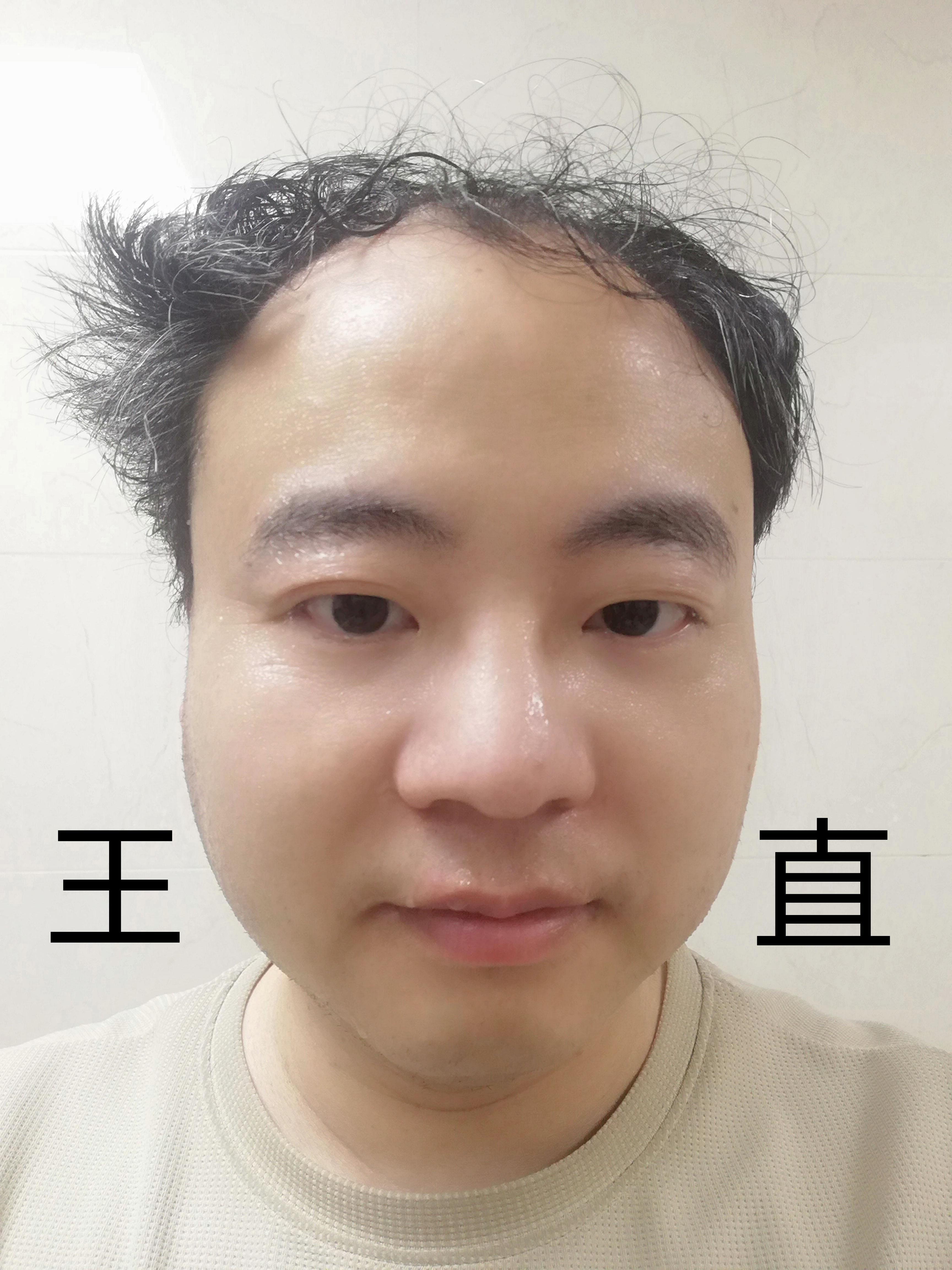 王朝晖